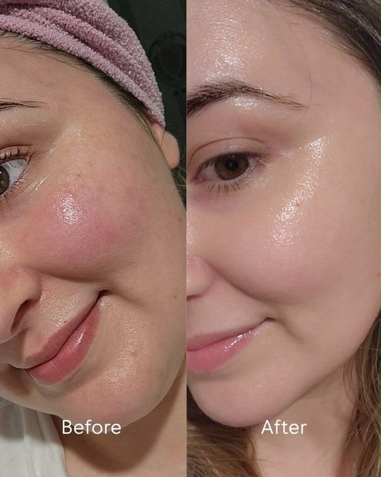 Brightening Serum